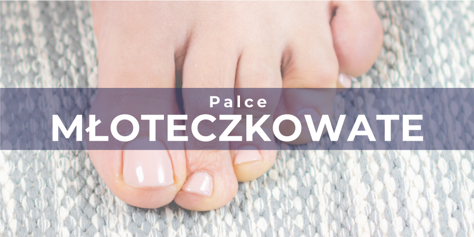 PALCE MŁOTECZKOWATE