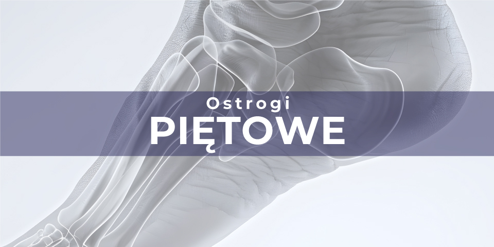 OSTROGI PIĘTOWE