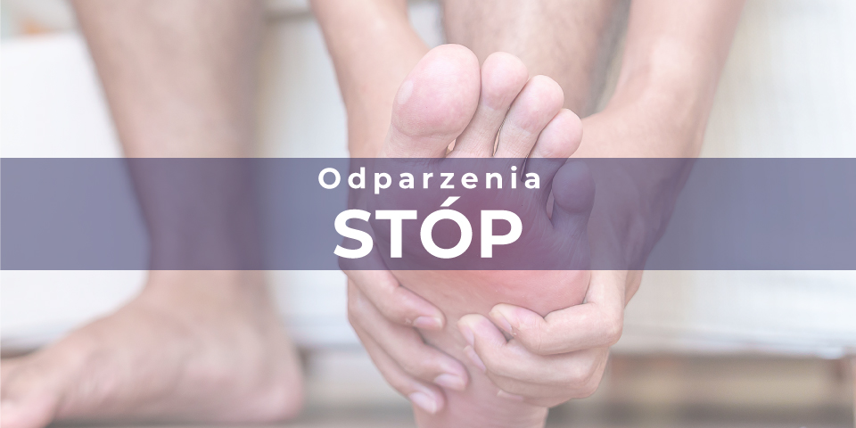 ODPARZENIA STÓP